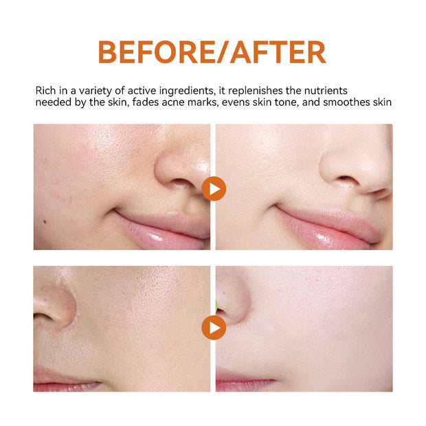 Mosecare Turmeric Hydrating Facial Mask – Moisturizing & Brightening Skincare Sheet Mask