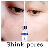 Mosecare Hyaluronic Acid Facial Serum – Deep Moisturizing, Pore Minimizing & Skin Brightening