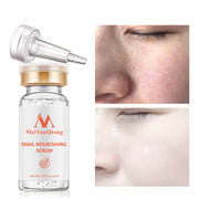 Mosecare Snail & Hyaluronic Acid Serum – Whitening, Moisturizing & Spot Repair Essence (12ml)