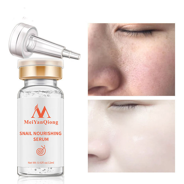 Mosecare Snail & Hyaluronic Acid Serum – Whitening, Moisturizing & Spot Repair Essence (12ml)