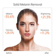 Mosecare Vitamin C Facial Serum – Hydrating & Moisturizing Skin Care Essence (15ml)