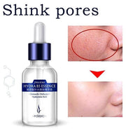 Mosecare Hyaluronic Acid Facial Serum – Deep Moisturizing, Pore Minimizing & Skin Brightening