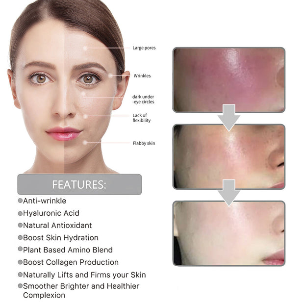 Mosecare Vitamin C Serum – Wrinkle Fading, Firming & Skin Rejuvenation Essence (30ml)