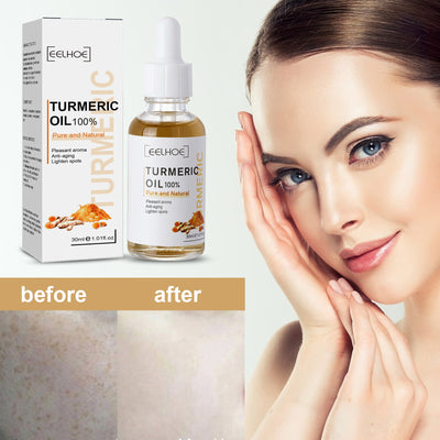 Mosecare Turmeric Dark Spot Correction Serum – Moisturizing & Skin Tone Repair Face Care
