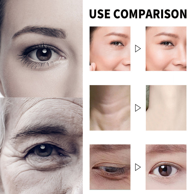 Mosecare Vitamin C Serum – Wrinkle Fading, Firming & Skin Rejuvenation Essence (30ml)